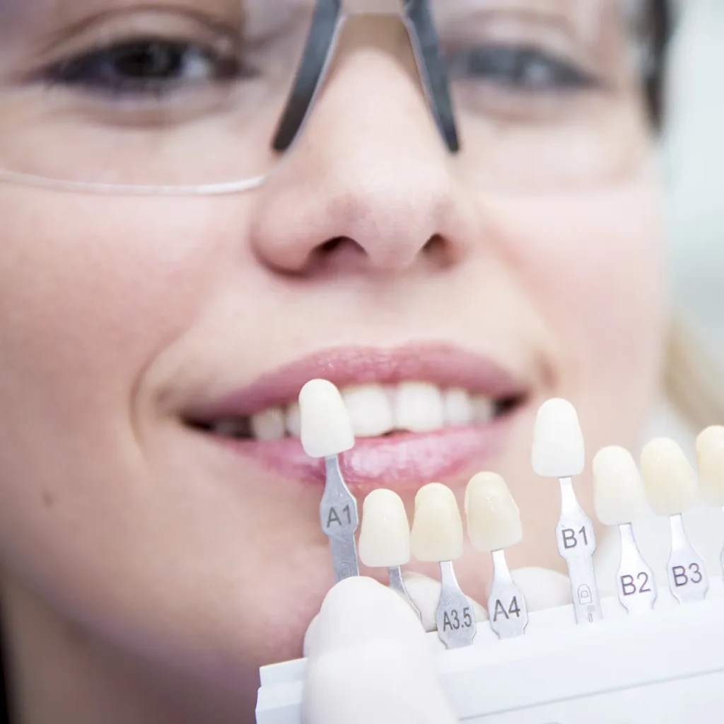 pacjentka ma dobierany kolor zębów przed wybielanie Skierniewice